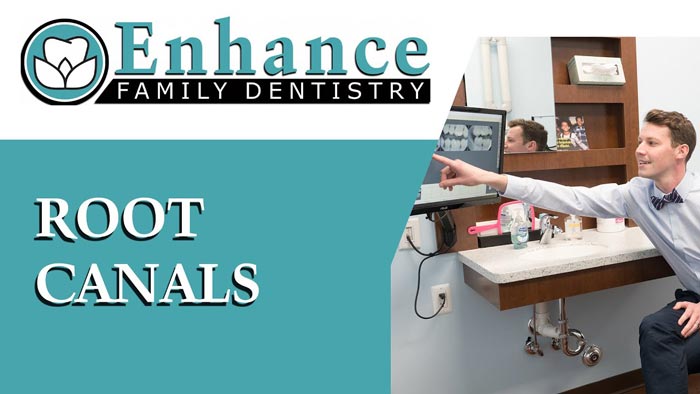 Root Canal Dentists Ann Arbor Mi